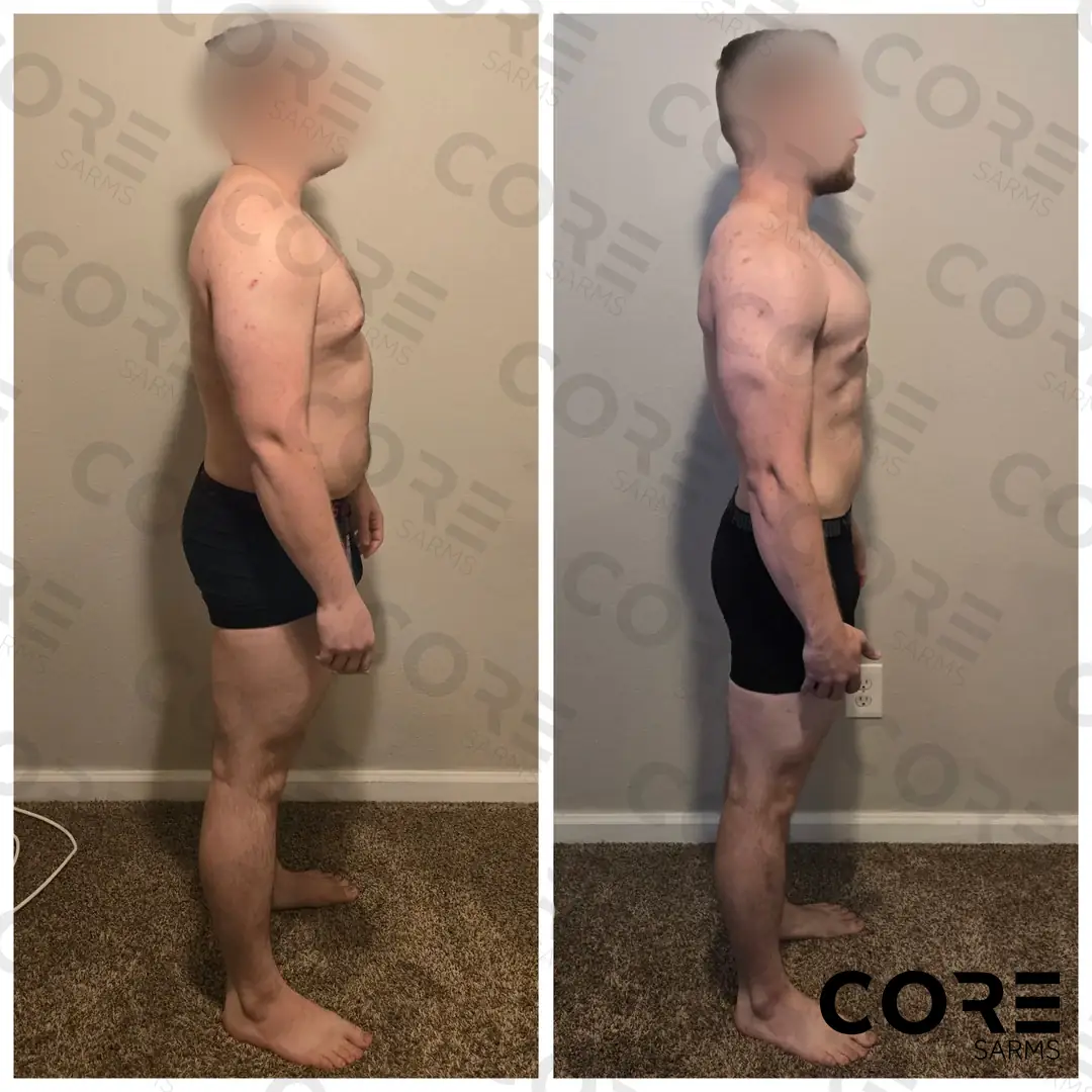 Stenabolic